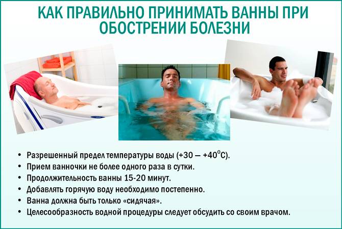 Как выбрать акриловую ванну: на что обращают внимание при покупке